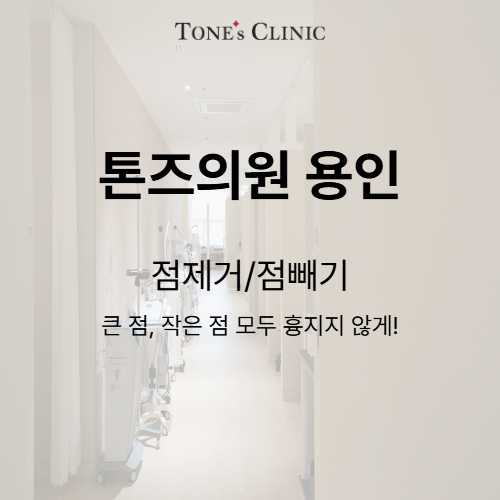 점빼기