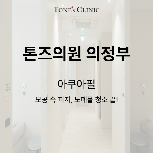 아쿠아필