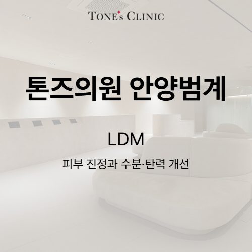 LDM