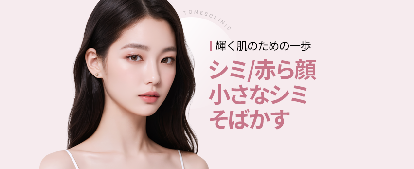 レーザー