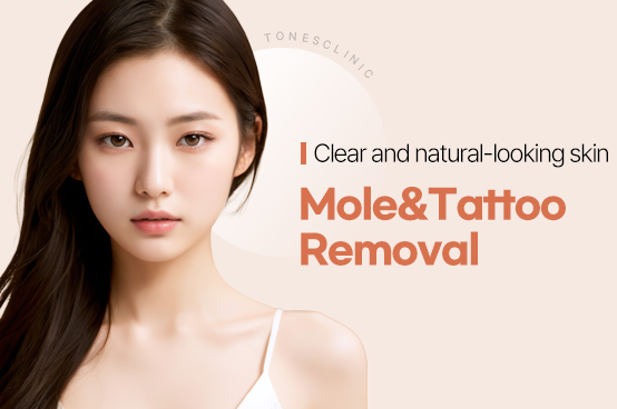 SPOT & TATTOO REMOVAL