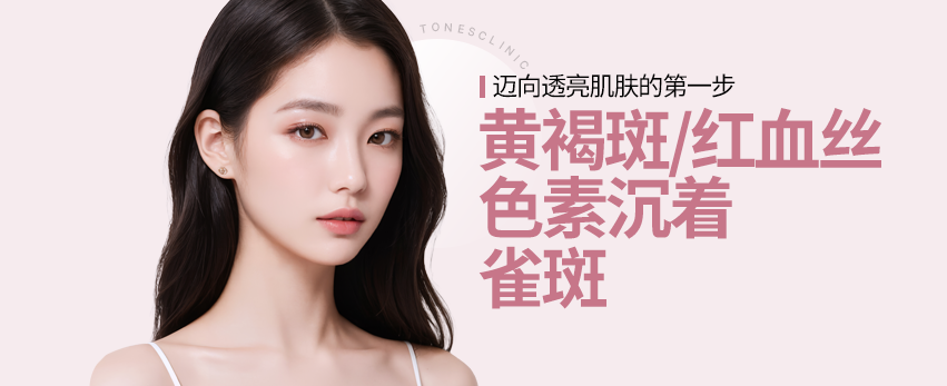 激光治疗