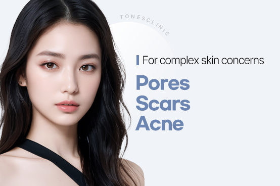 Pores / Scars / Acne