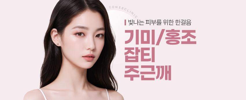 레이저