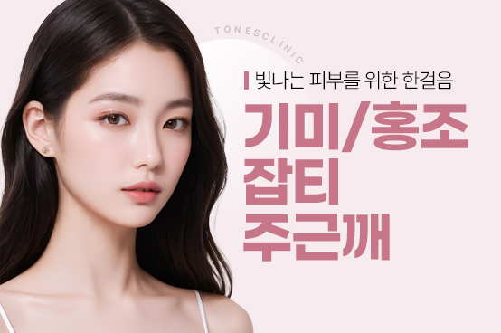 레이저