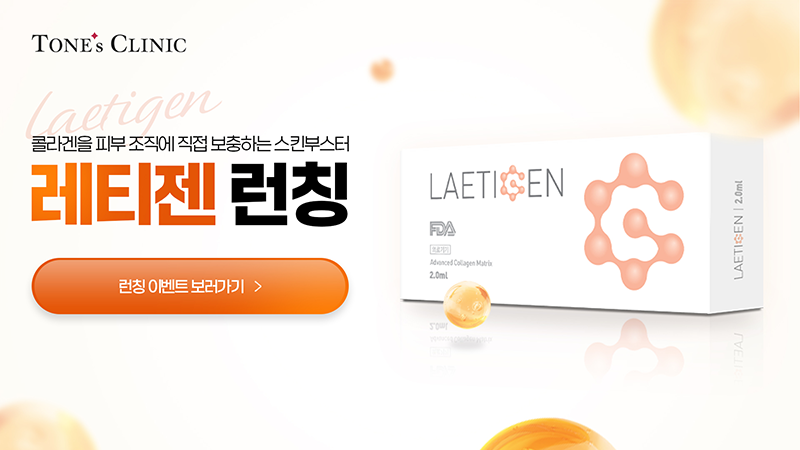 팝업