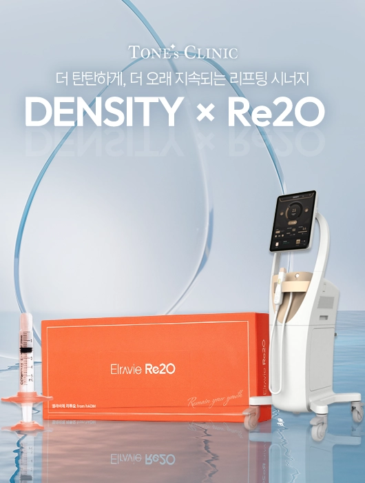 팝업