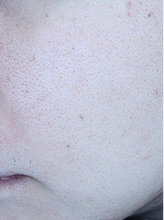 더마홍조+포텐자